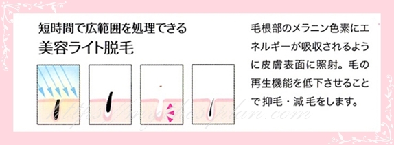 ライト脱毛の仕組みの図解・ライト脱毛は抑毛効果で、徐々に毛を減らす脱毛法